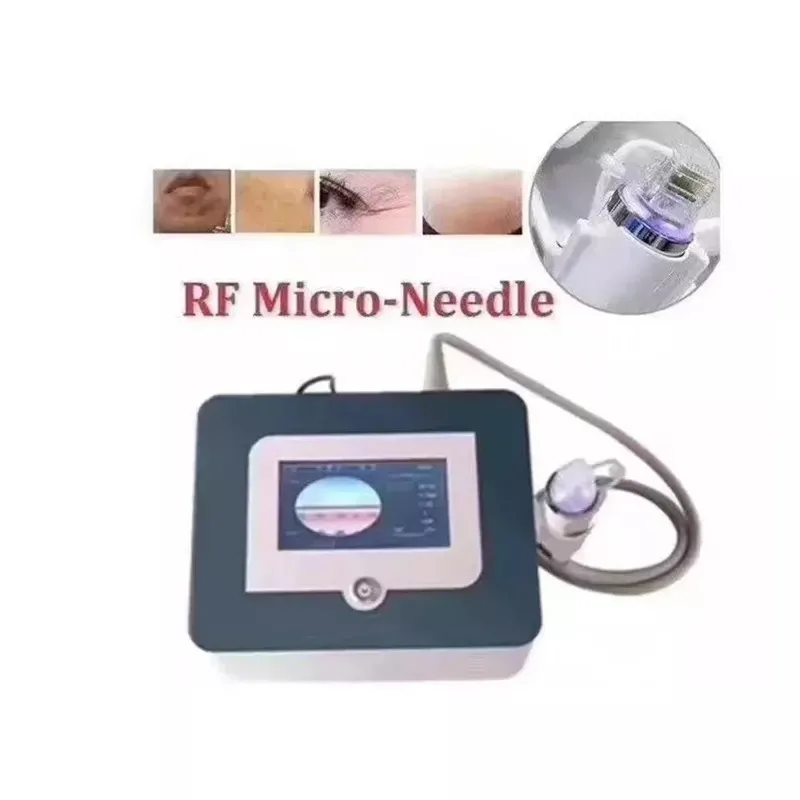 "Magical radio frequency dot matrix microneedle to remove stretch marks