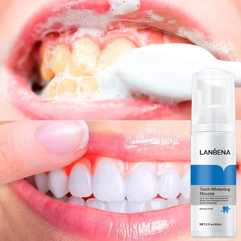 

LANBENA Teeth Whitening Mousse Oral Care Tooth Cleaning Toothpaste Dental Oral Hygiene Remove Stains Plaque Bleaching Tool 60g