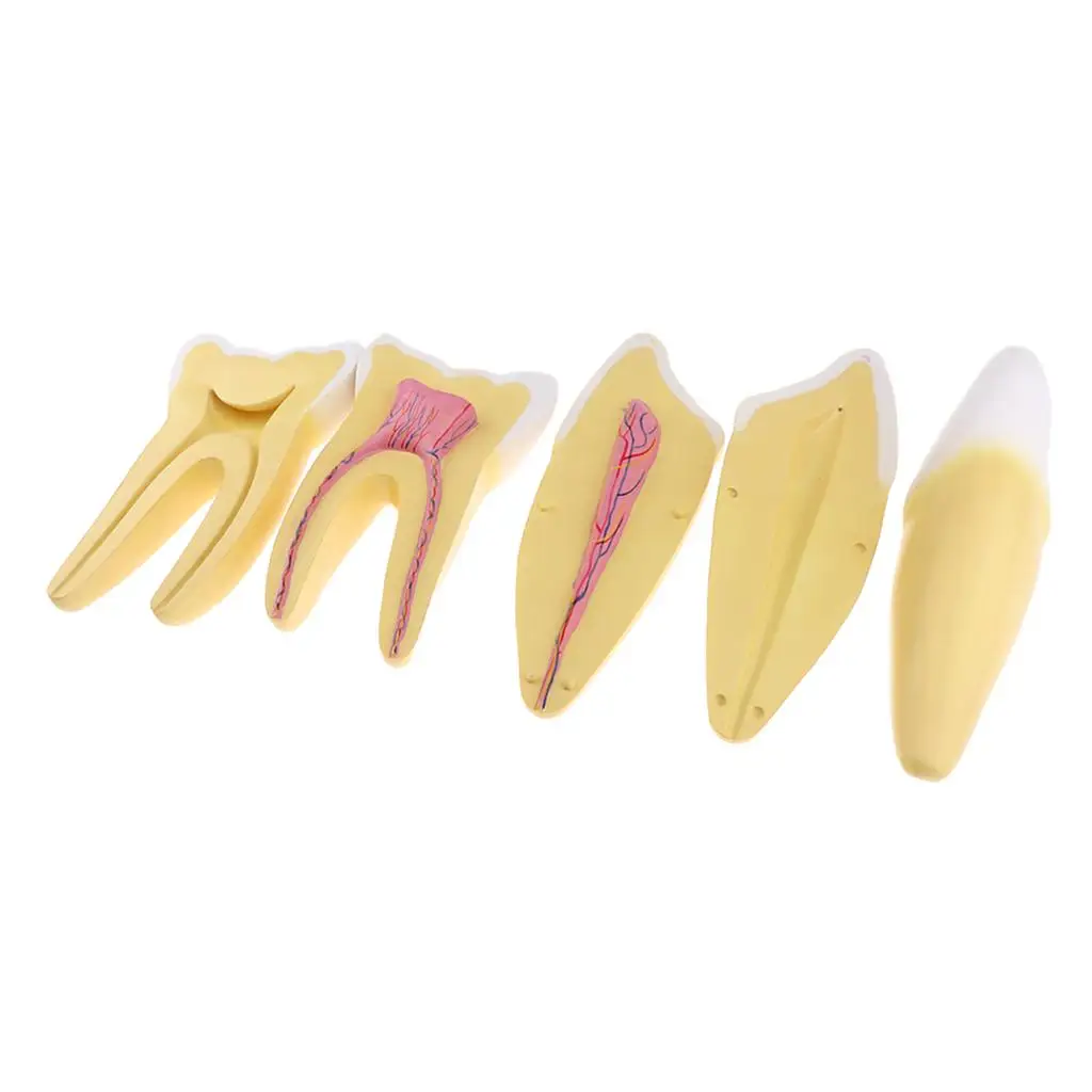 

Magnified Teeth Endodontic Model for Study Teaching Teeth Model, 9.84 x 4.72 x 3.94 inch