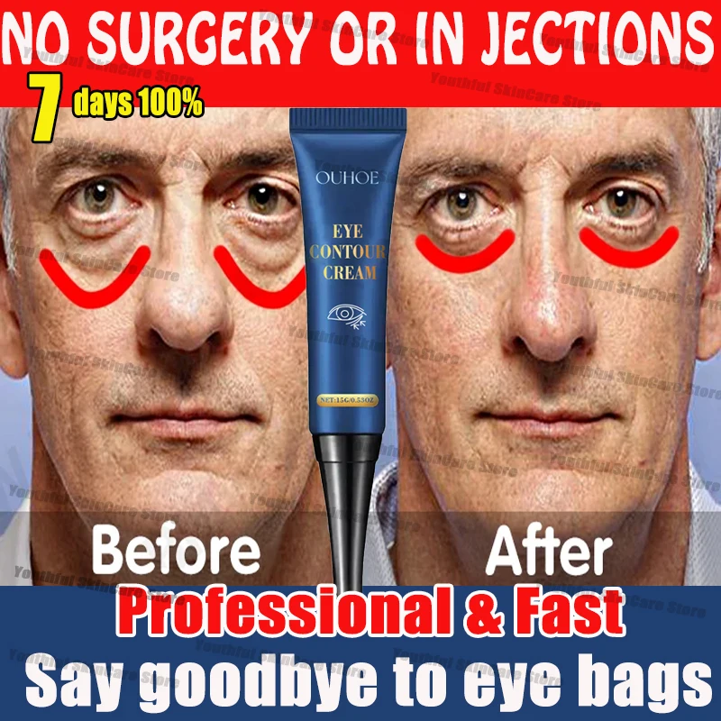 Антивозрастной крем для области вокруг глаз от Тёмных кругов и мешков под