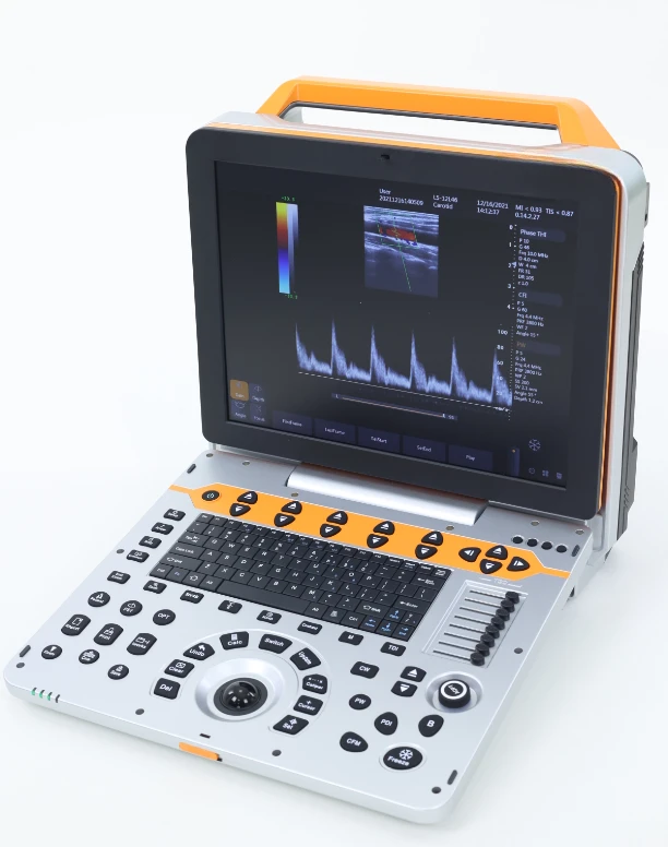 MT MEDICAL Больничный 12-цветный ЖК-экран и пятиуровневый ультразвуковой сканер с
