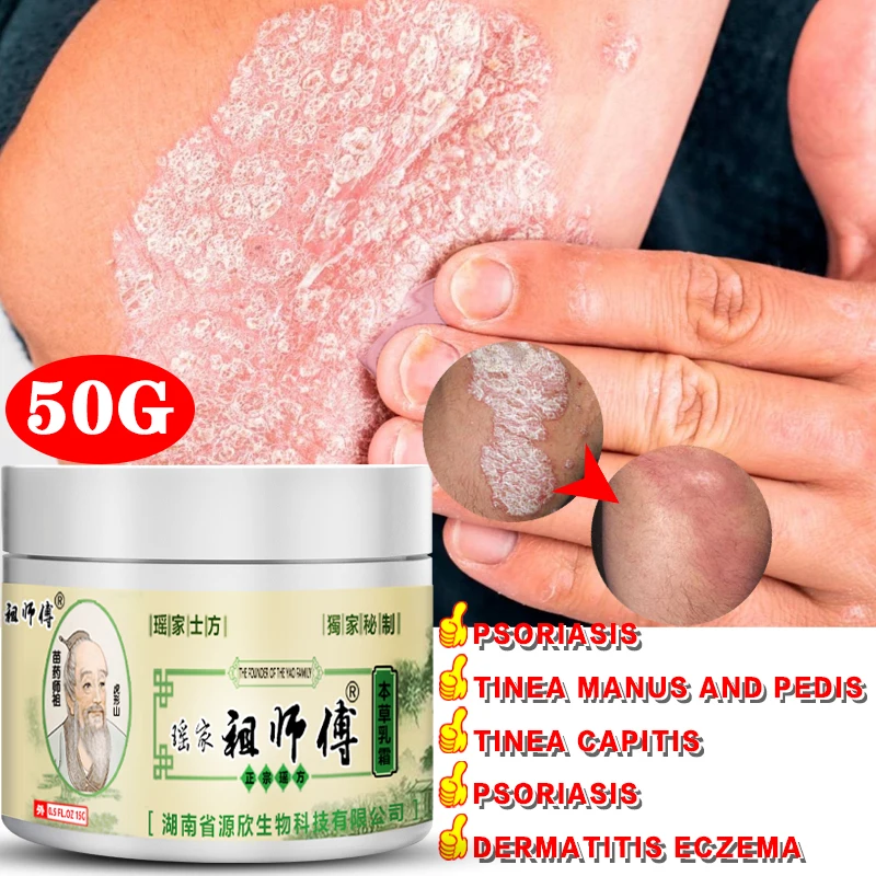 

Bacteriostasis Antipruritic and Skin Repair Cream Relieve Psoriasis Dermatitis Eczema Pruritus WITH Psoriasis Cream