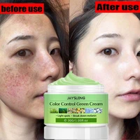 whitening freckles cream remove melasma dark spot lightening melanin brightening melasma remover moisturize anti aging face care