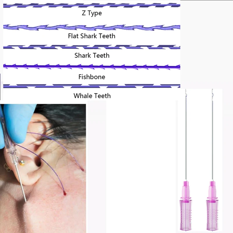 

10pcs Pdo Threads Hilos Tensores Wire 3d 4d 6d 8d Cog Molding Press Shark Whale Teeth Fox Eye Face Body Lift Skin Tightening Pdo