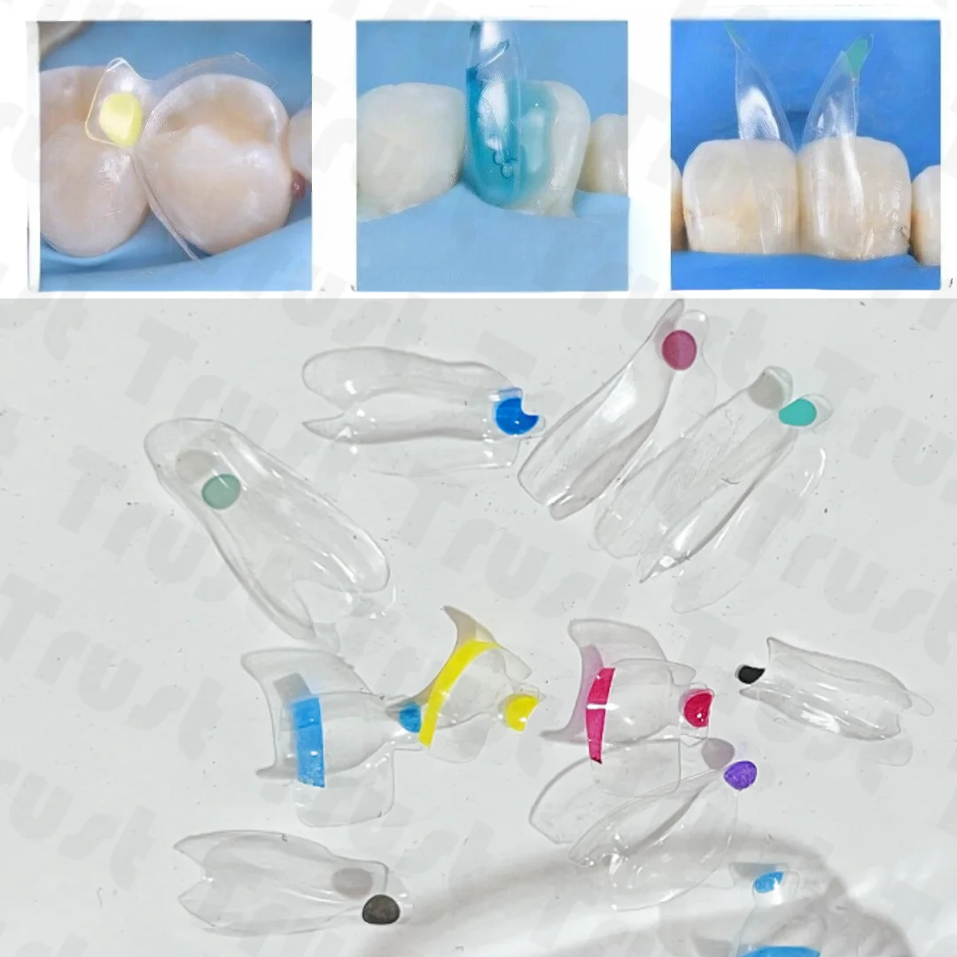 25 шт./кор. стоматологические прозрачные матричные ленты матрицы передний