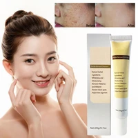 face freckle removal cream moisturizing repair whitening remove melasma melanin prevent black spots reduce pimple skin care faci