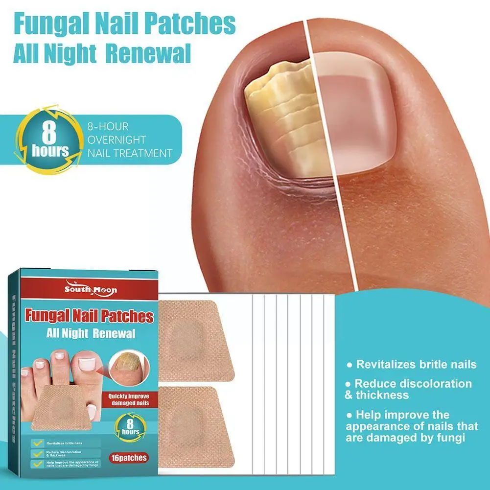 

Nail Care Patch Anti-fungal Nail Correction Patch Embedded Paronychia Care Patch Anti-infection Toenail Repair I2E3