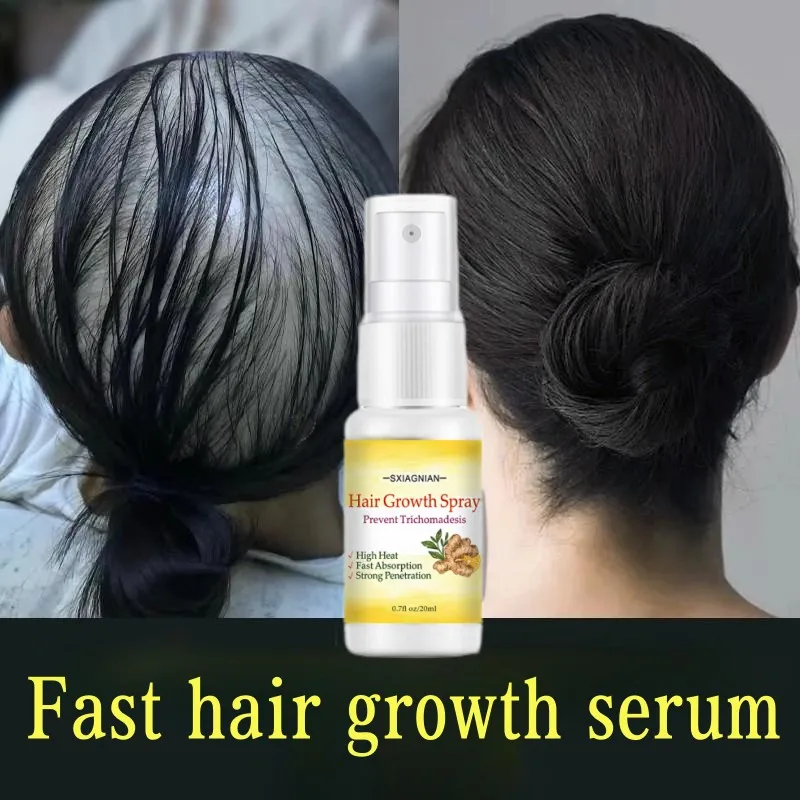 

10PCS Ginger Hair Growth Essence Spray Fast Hair Growth Serum Nutrient solution Hair Loss Treatment Scalp Care Men Women