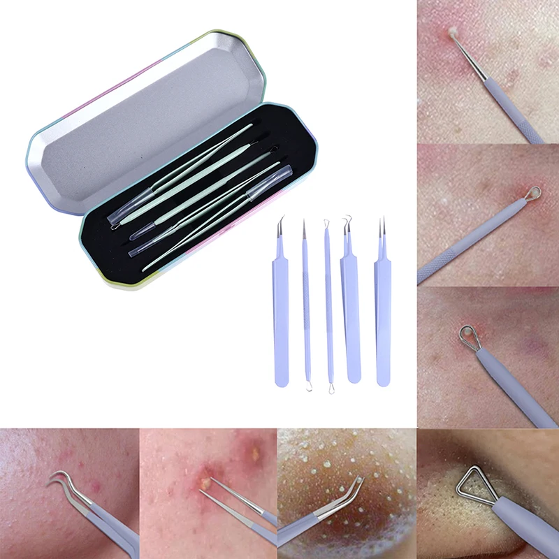 

5Pcs Stainless Steel Acne Needle Blackhead Remover Pimple Blemish Comedone Extractor Tweezer Kit