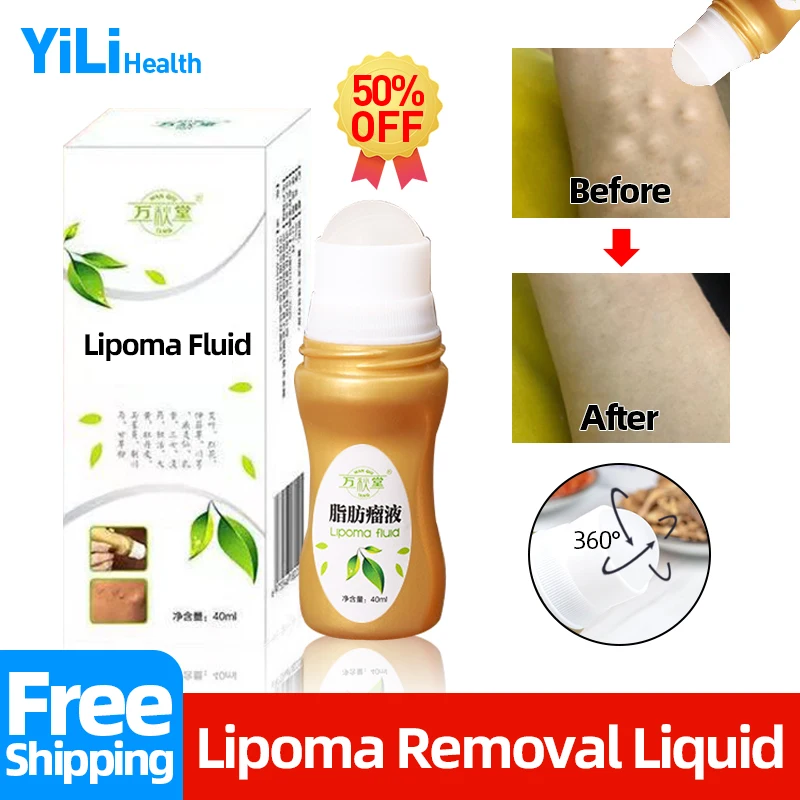 

Lipoma Remover Liquid Cellulite Treatment Cream Fat Mass Plaster Apply To Subcutaneous Lumps Fibroma Medicine 360° Ball Massage