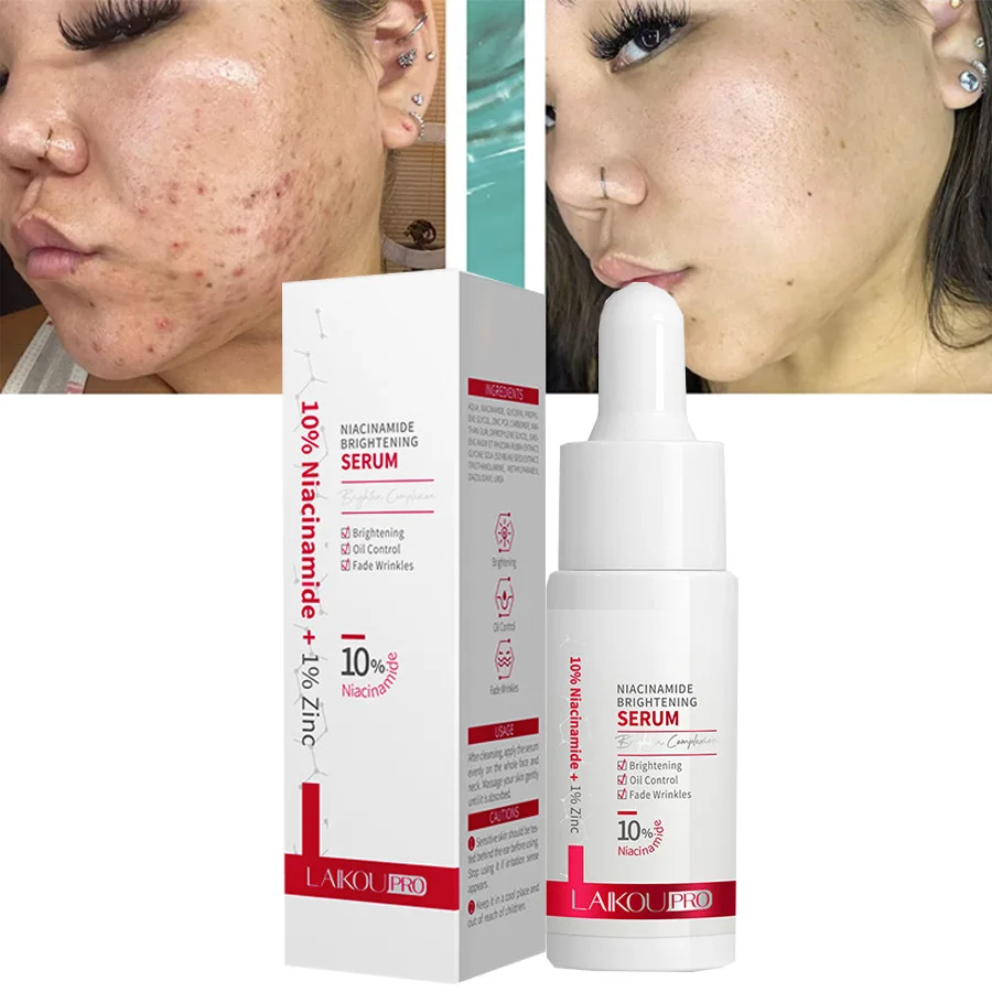 

10% никотинамид + 1% цинковая лампа, антивозрастная Сыворотка для ухода за кожей от морщин