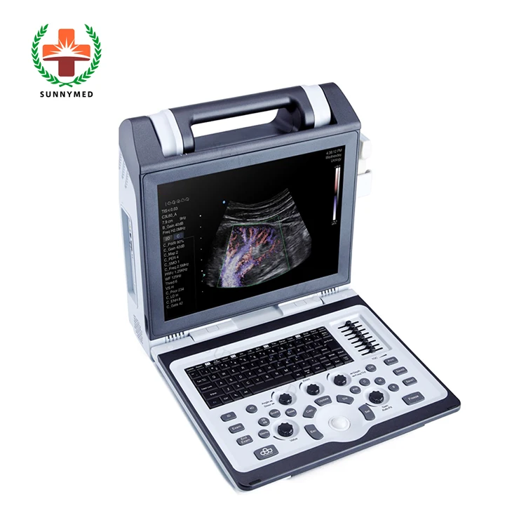 

SY-A2100 Color Doppler Ultrasound 3D 4D Portable Ultrasound Machine For Pregnancy