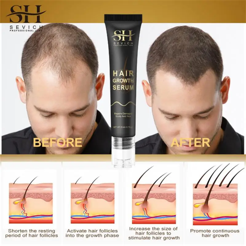 

20ml Hair Beads Massage Scalp Nutrient Solution Thick Hair Moisturizing Anti Loss Hair Serum Scalp Care Germinal Fluid Beauty