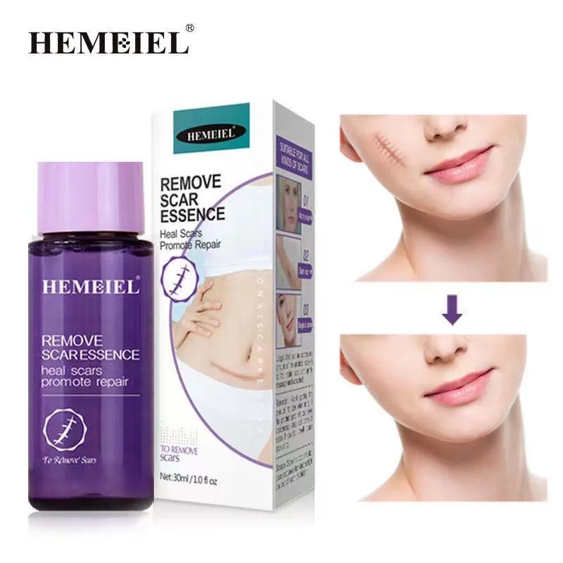 

Сыворотка для удаления шрамов от акне, растяжек, лечение прыщей, восстановление пятен, уход за кожей, увлажнение, гладкое отбеливание, косме...