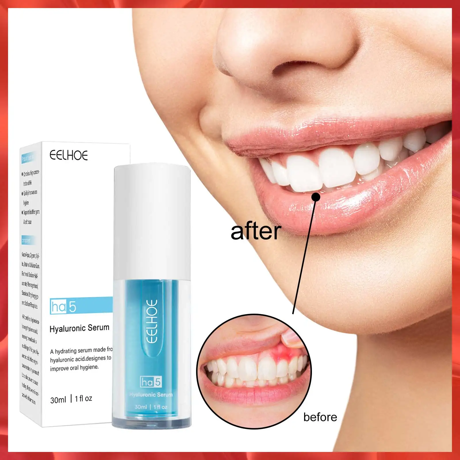 

Eelhoe Soda Toothpaste Whitening HA5 Stain Removal Sensitive Strong Effect Bleeding Breath Fresh Breath Anti-cavity Solid Teeth