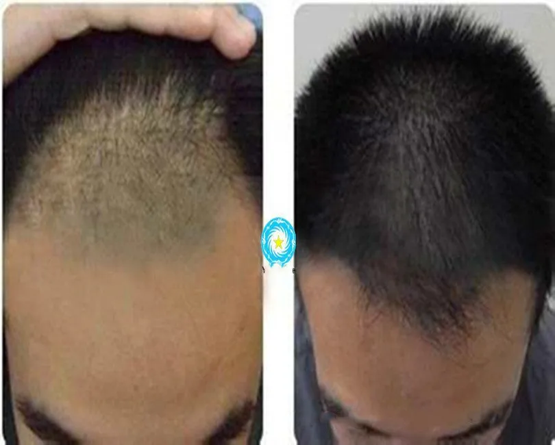

50mg Tripeptide, hair growth peptide cosmetic material ,anti-hair loss Promote hair growth