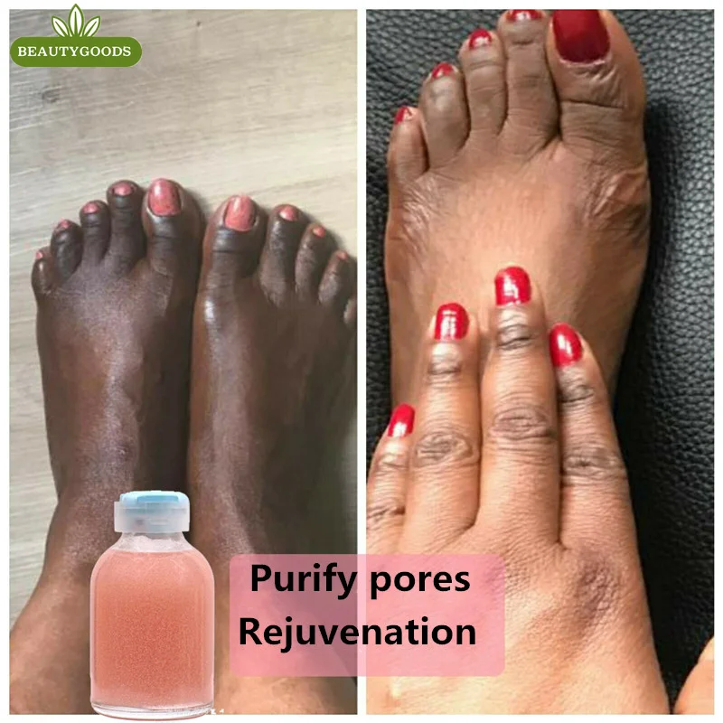 

Сильный крем для рук и ног, бриллиантовая Сыворотка для темной кожи, для очистки суставов, для плавления, осветления