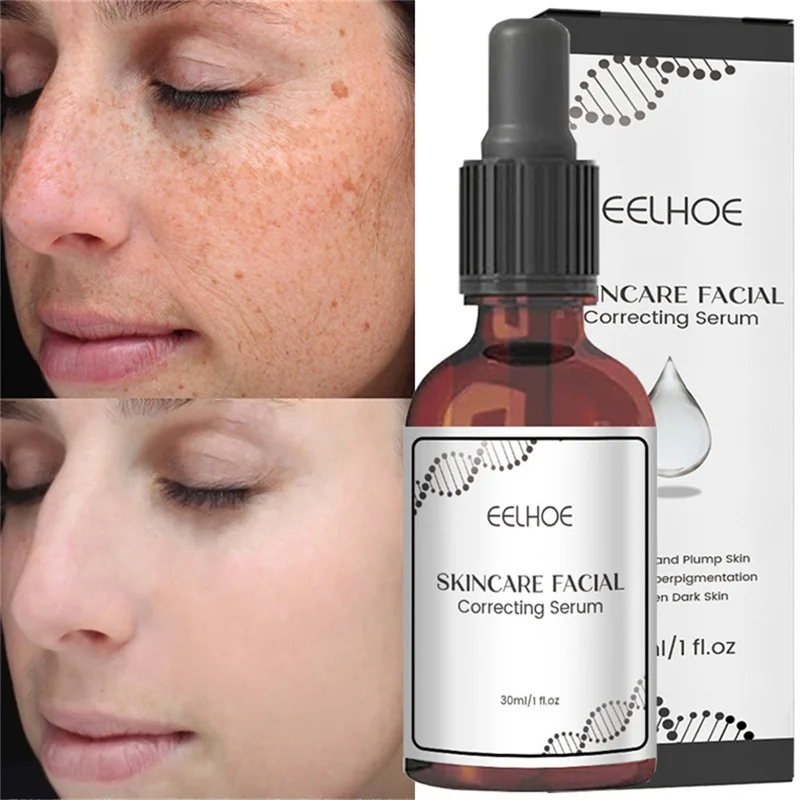 Whitening Freckle Serum Effective Remove Melasma Dark Spots Melanin Anti Aging Moisturize Brighten Smooth Face Skin Care