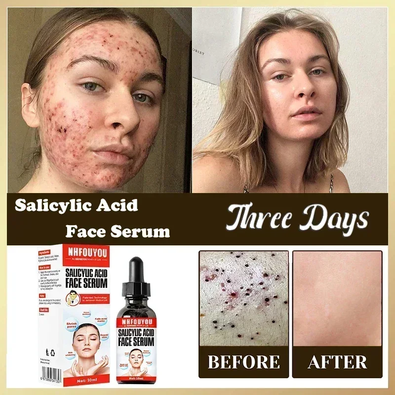 Раствор с салициловой кислотой 10 мл