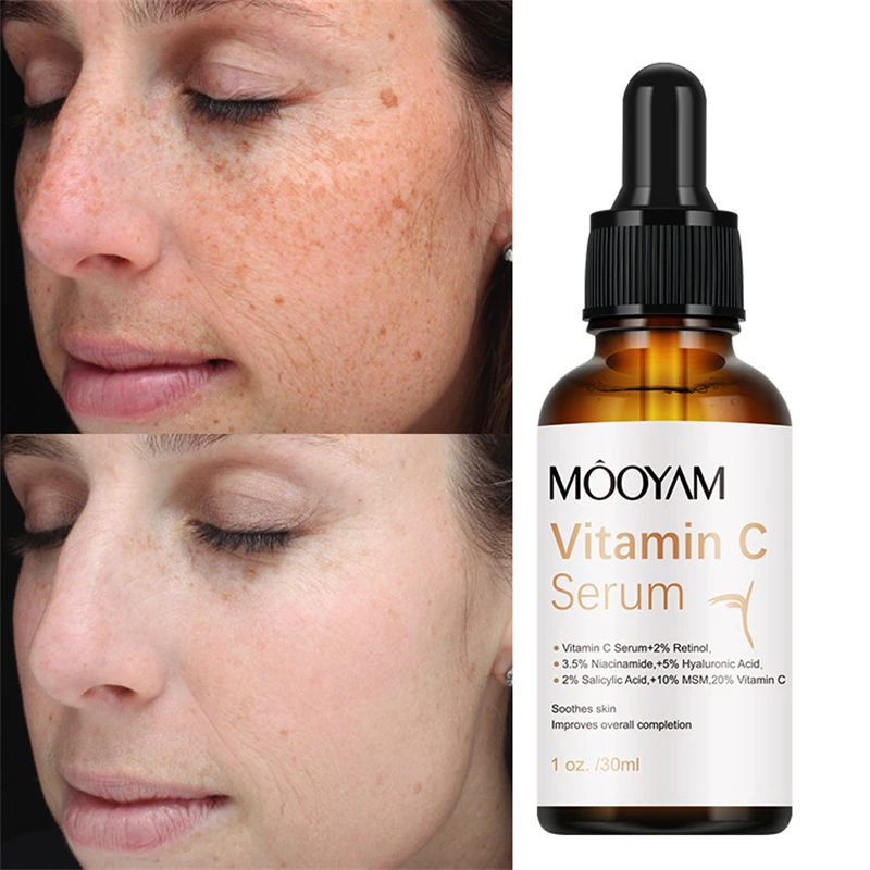 Whitening Freckle Facial Essence Remove Acne Spots Melanin Dark Spots Face Serum Lift Firming Moisturizing Brightening Skin Care