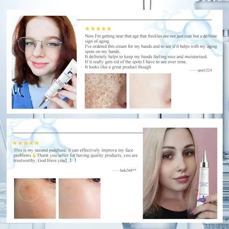 Отбеливающий крем для удаления меланина удаляет возрастные пятна и веснушки