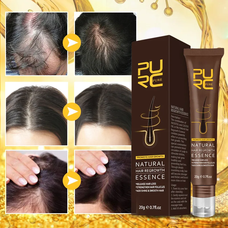PURC Natural Essence For Hair Growth Oil Scalp Massage Treatments Hair Loss Remedy Ginger Grow Hair Products Care For Women Men