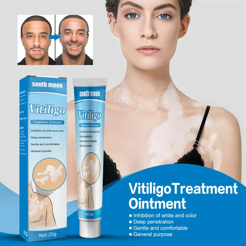

White Spot Disease Cream Vitiligo Ointment Treament Repair Leukoplakia Reduce Pigment Melanin Antibacterial Moisturing Skin Care