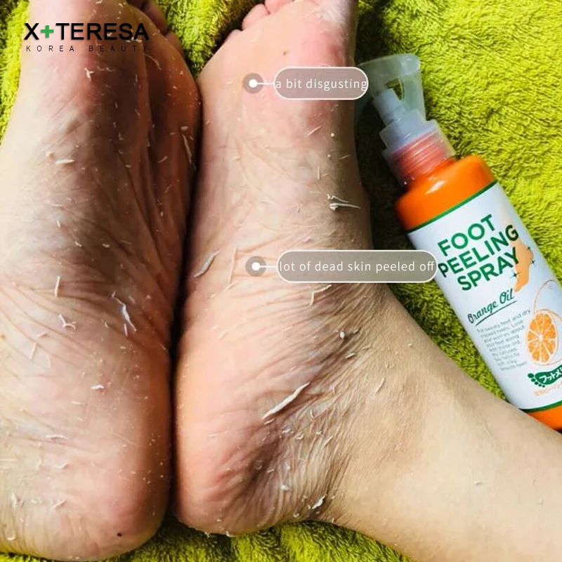 Бриллиантовый спрей для пилинга ног натуральная оранжевая эссенция педикюра