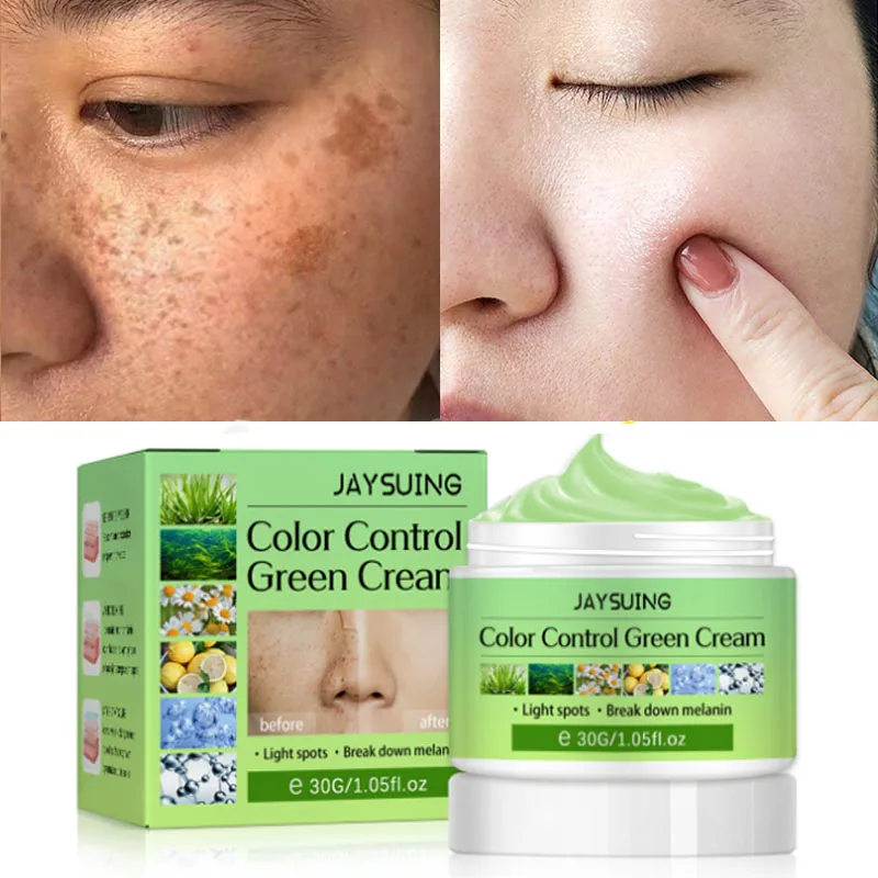 Whitening Freckle Cream Remove Melasma Pigmentation Lighten Dark Spots Improve Dullness Moisturizing Brighten Skin Care Products
