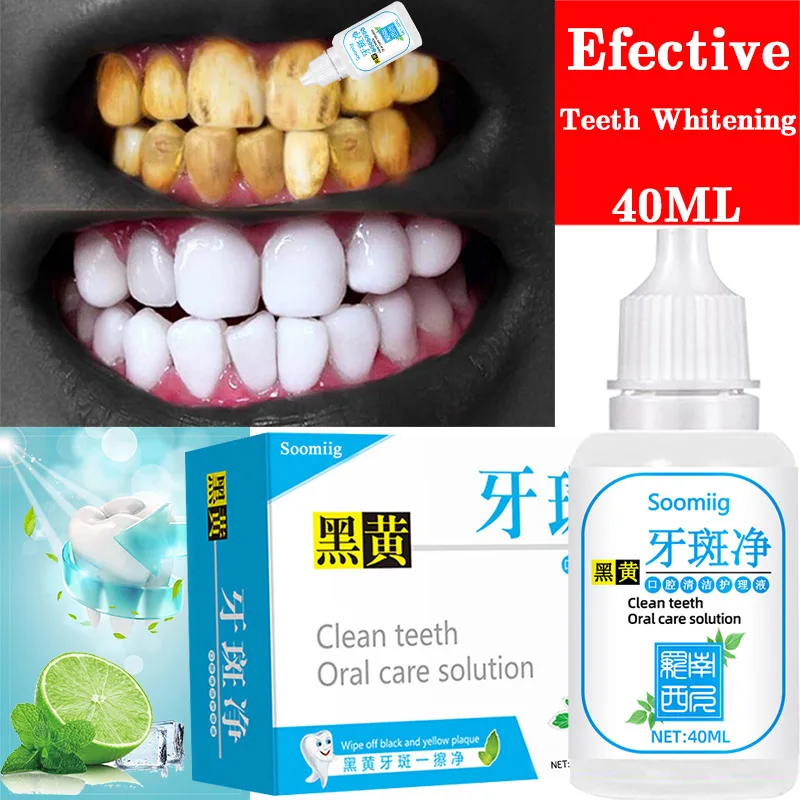 

(10-40ml) Tooth whitening essence oral hygiene cleaning effectively removes plaque stains yellow tooth whitening fresh breath
