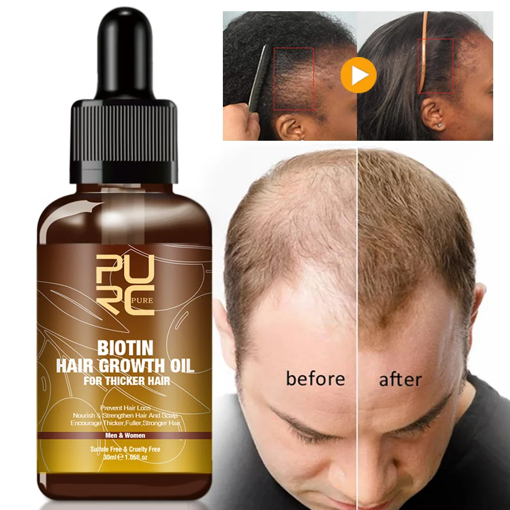 

PURC 30ml Hair Growth Products Biotin Fast Grow Hair Oil Beard Growth Oil Anti Loss Hair Spray For Men Women Beauty Health Care