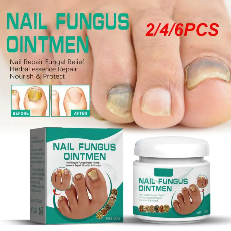 

2/4/6PCS 20g Nail Fungus Very Stronger Removal Feet Care Cream Fungus Removal & Repair Gel Anti- Parasitic