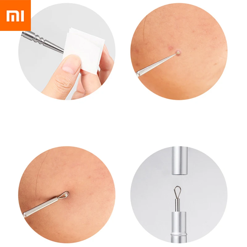 Xiaomi Youpin Jordan Judy инструмент для удаления чёрных точек и прыщей из нержавеющей стали