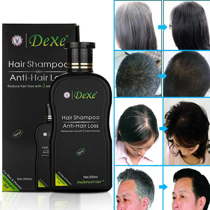 2pcs 200ml Dexe Hair Growth Shampoo Set Anti-hair Loss Chinese Herbal Hair Growth Product Prevent Hair Treatment hair care