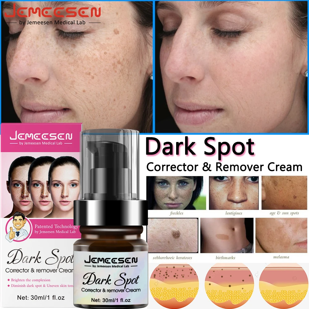 

Jemeesen Freckle Whitening Cream Brighten Fade Dark Spot Corrector Removal Pigment Melanin Correcting Beauty Face Skin Care 30ML