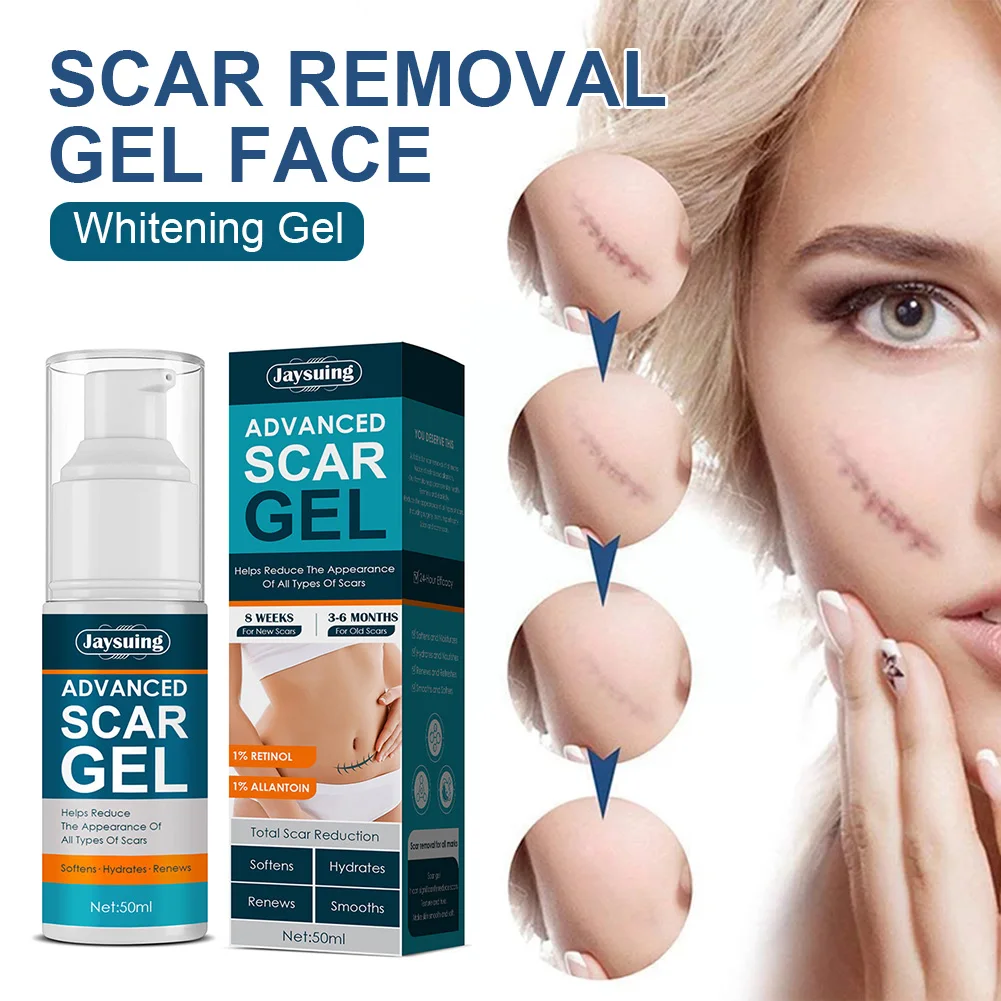 

50ml Scar Removal Gel Face Pimples Stretch Marks Burns Acne Scar Treatment Skin Repairing Whitening Gel Skin Care Tool