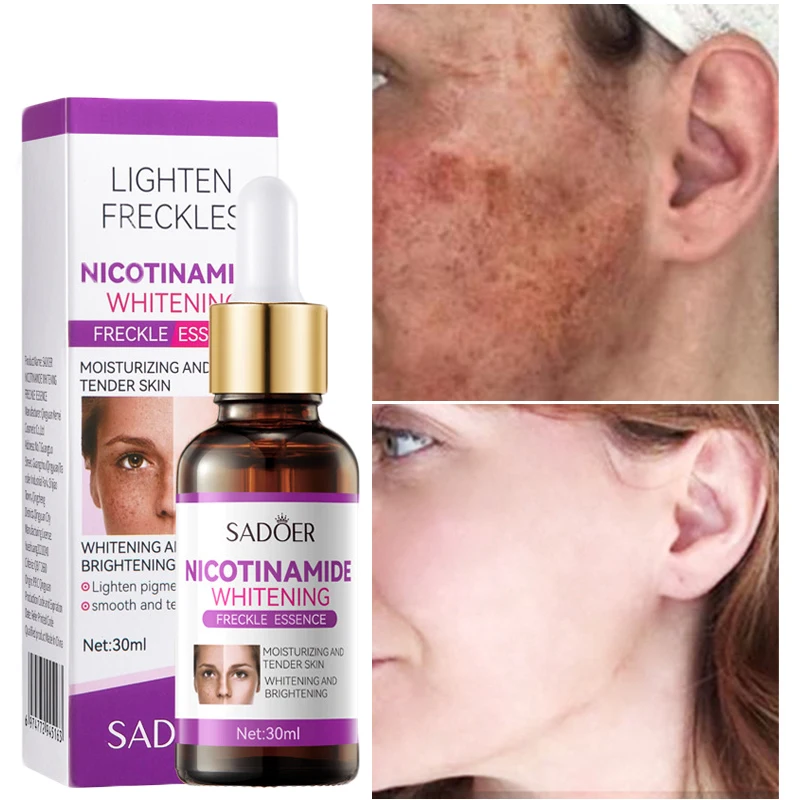 

Effective Whitening Serum Remove Dark Spots Freckle Melasma Essence Fade Melanin Moisturizing Brighten Smoothing Face Skin Care