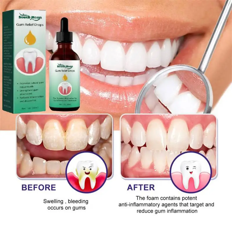 

30ml Repair Drops Clean Teeth Whitening Remove Teeth Macular Soothe Gum Tooth Repair Drops Toothpaste Oral Hygiene Clean Care