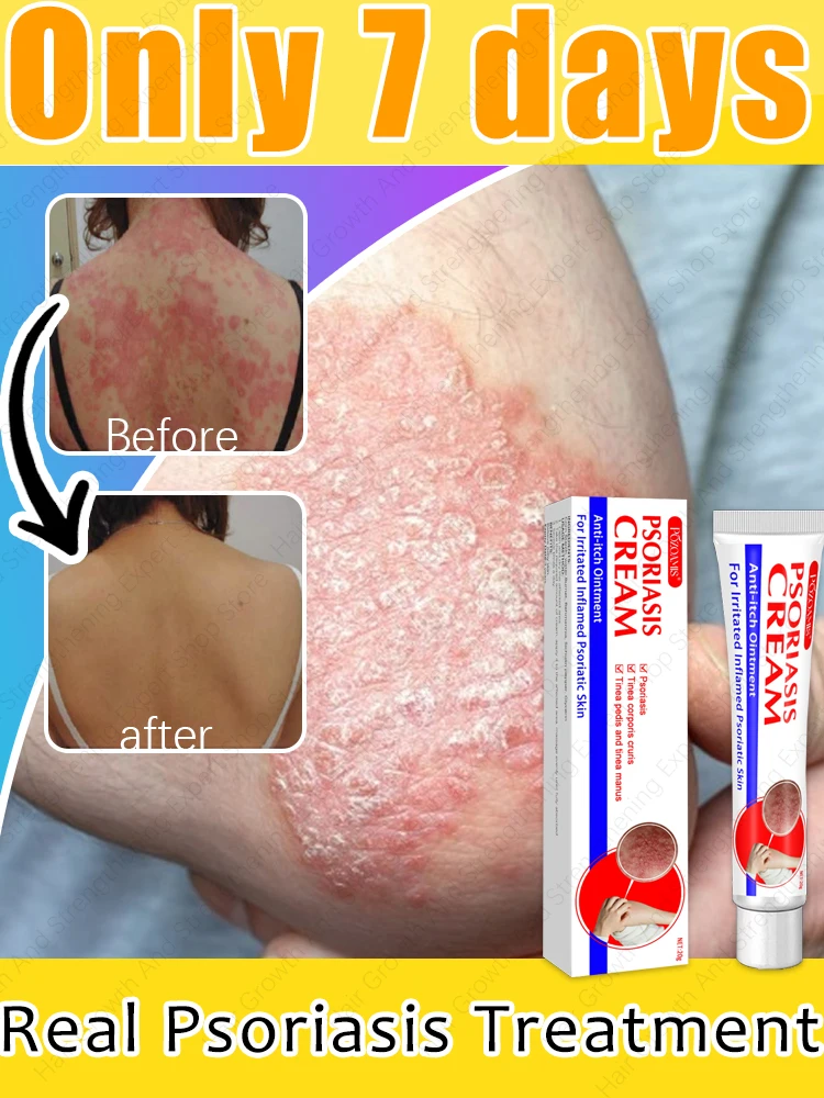 Ортопедический инструмент для ухода за ногами