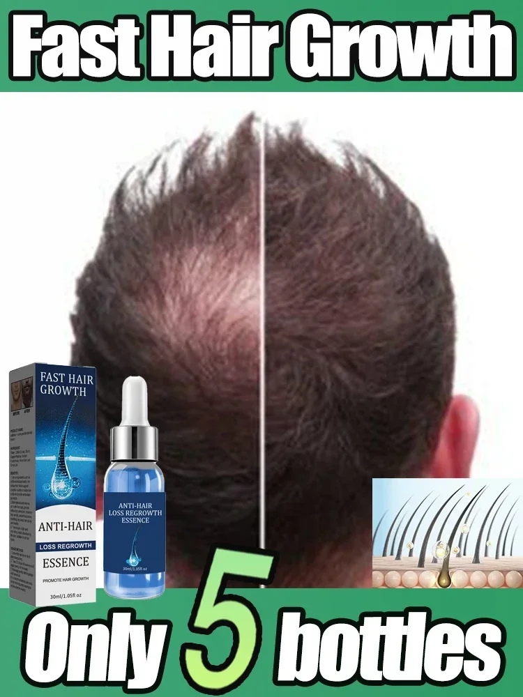 Эфирное масло для роста волос укрепления лечение сухой Mila органическое эфирное