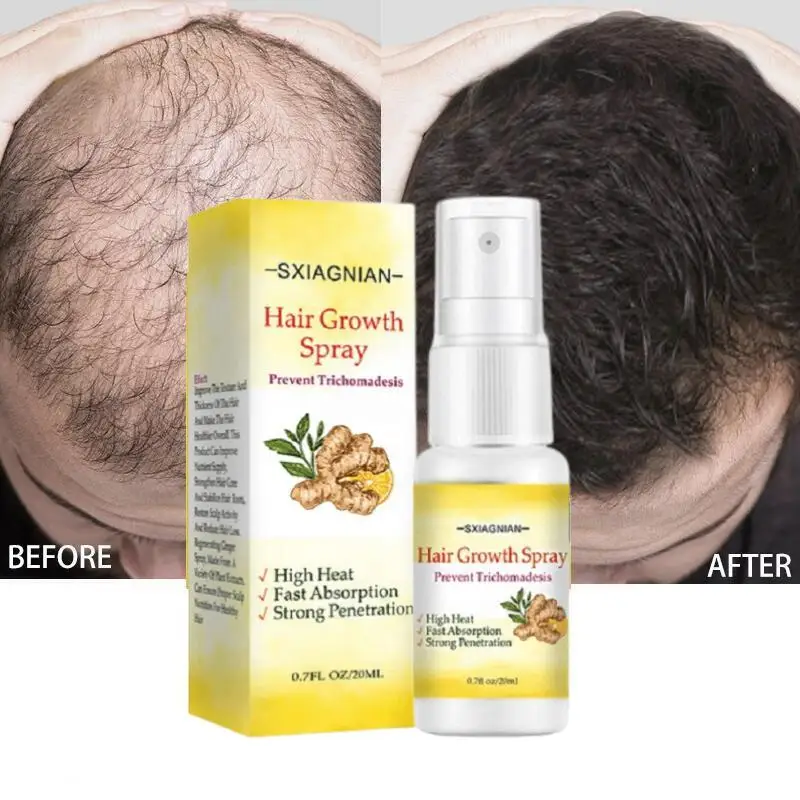 

Ginger Fast Hair Growth Serum Spray Effective Prevent Baldness Scalp Treatment Repair Hereditary Postpartum Seborrheic Hair Loss