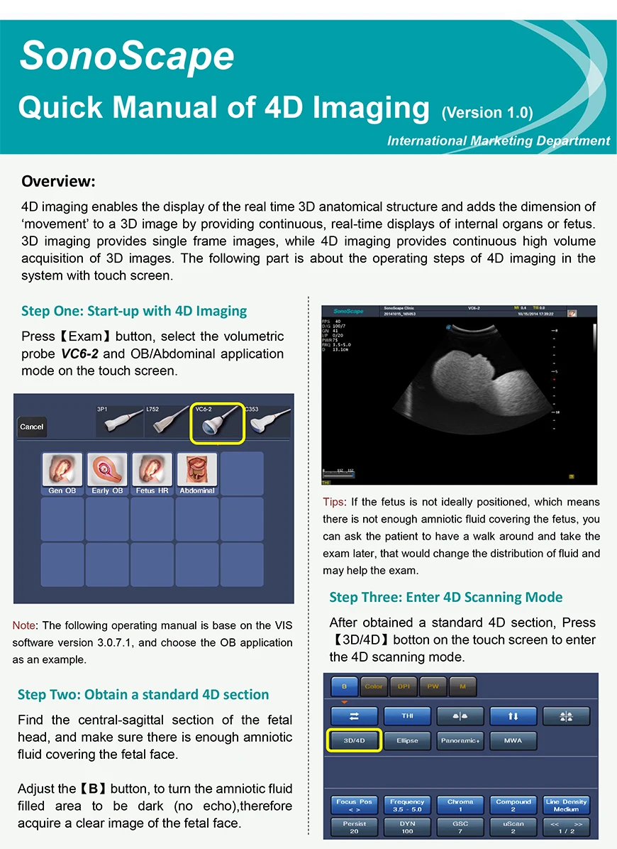 Портативный ультразвуковой сканер медицинские ультразвуковые инструменты от