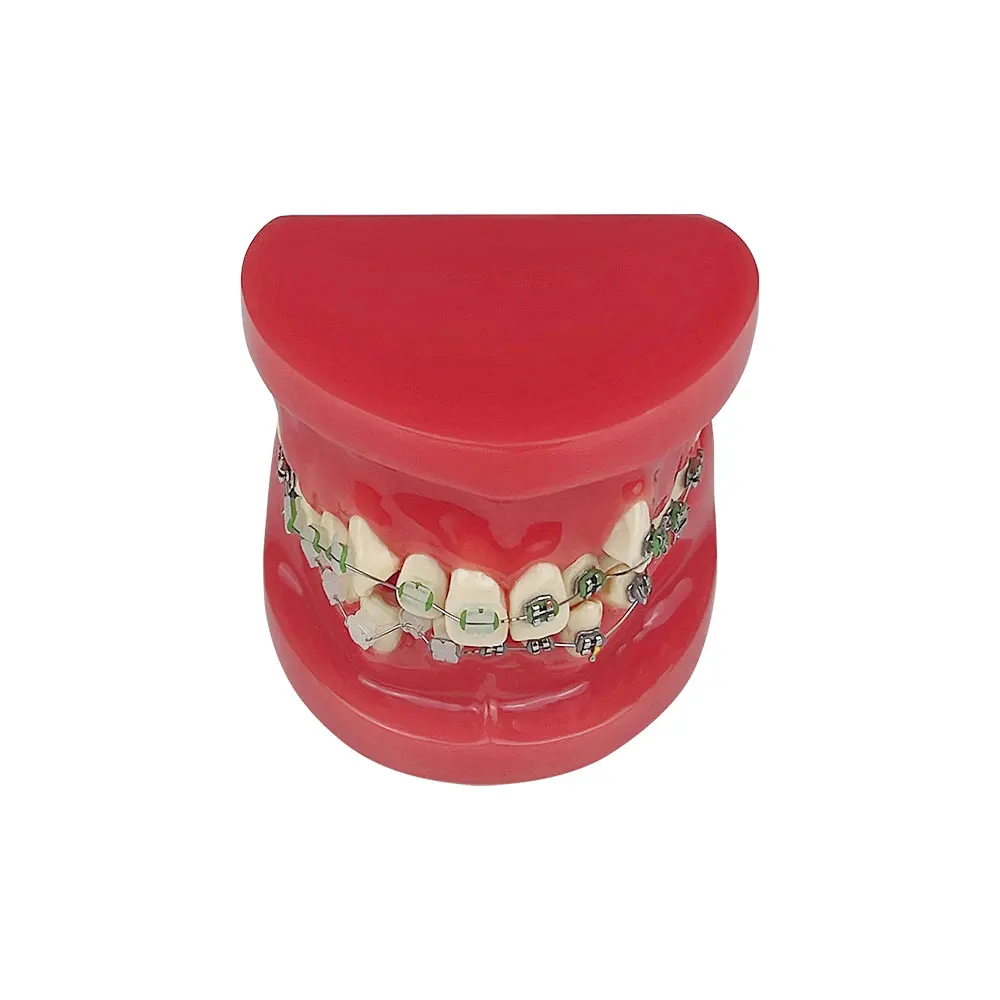 Стоматологическая ортодонтическая модель лечение зубов стандартная обучающая