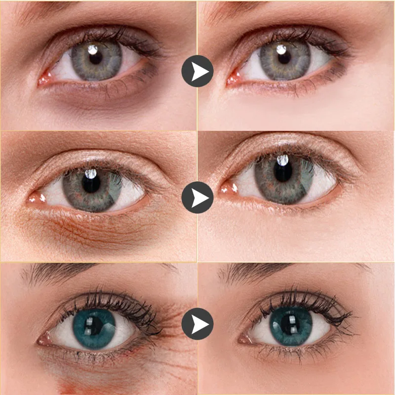 Magic Anti Wrinkle Eye Cream Fade Dark Circles Bags Lift Firm Fine Lines Anti-Aging Anti-Puffiness Serum Eyes Contour Care |