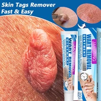 wart removal cream fast warts mole remover gel treatment safe painless skin tags remove ointment repair smooth whiten skin care