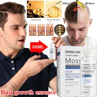 mosslay hair growth products essence oil hair care hair treatment hair growth serum organic anti hair loss beauty products