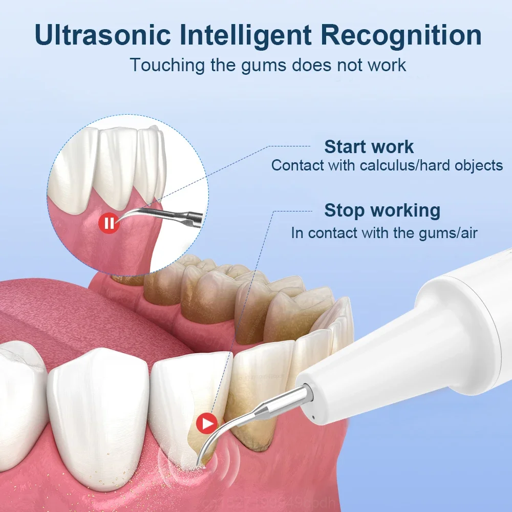 Ультразвуковой Ирригатор Для Полости Рта Зубная Нить Перезаряжаемый Очиститель