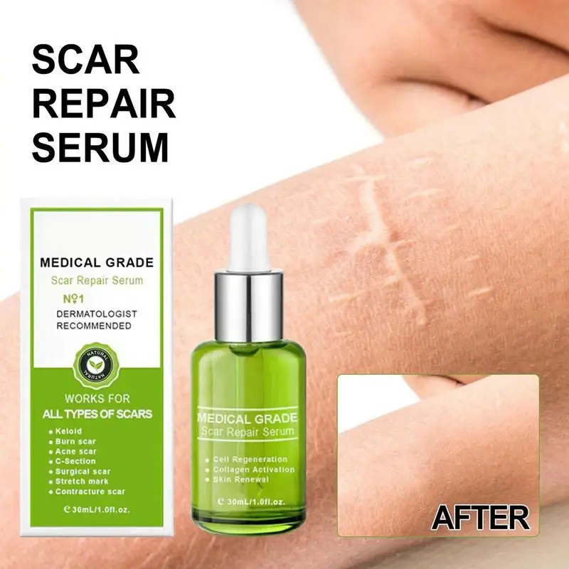 

Scar Removal Liquid 1.01oz Scar Guard Liquid With Aloe Extract Water Allantoin Scars Repair Essence Postoperative Scar Remover
