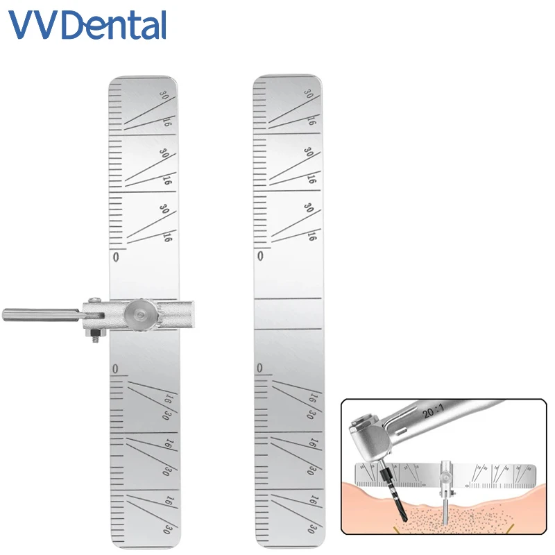 VVDental зубной имплантат