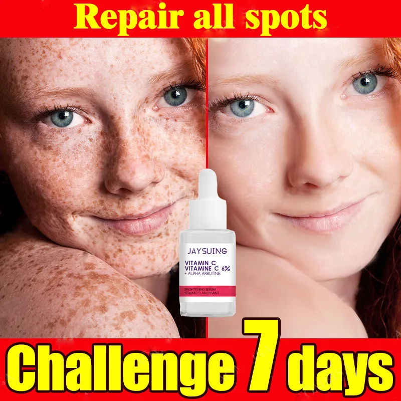 Vitamin C Whitening Freckles Face Serum Remove Melasma Dark Spot Lighten Melanin Essence Anti-Aging Acne Scar Brighten Skin Care
